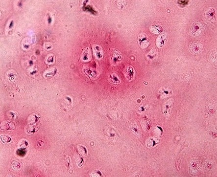 Hyaline cartilage