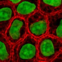 Stained Keratin Intermediate filaments