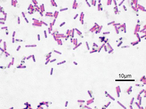 Gram staining of Bacillus Subtilis