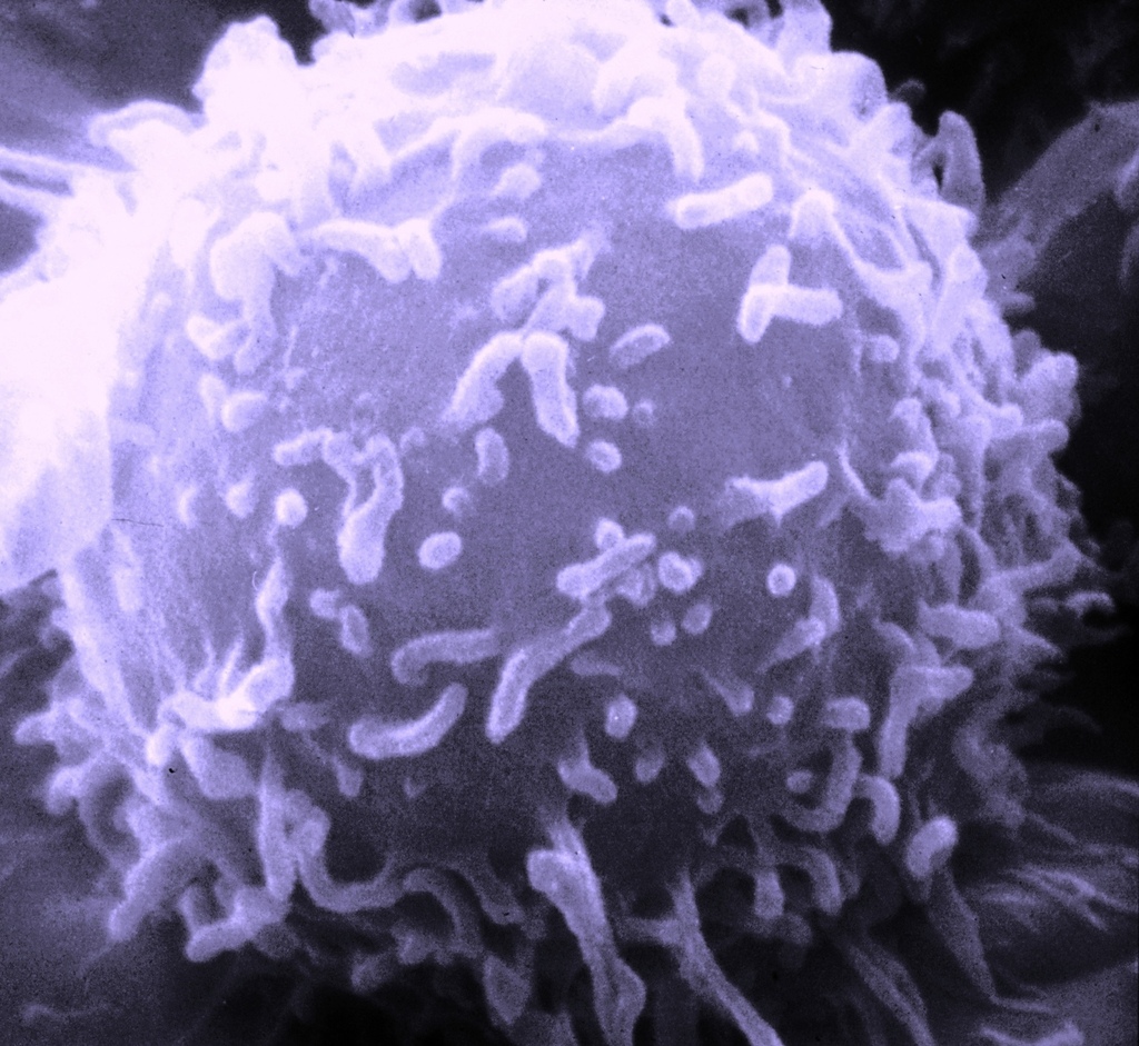 SEM Lymphocyte