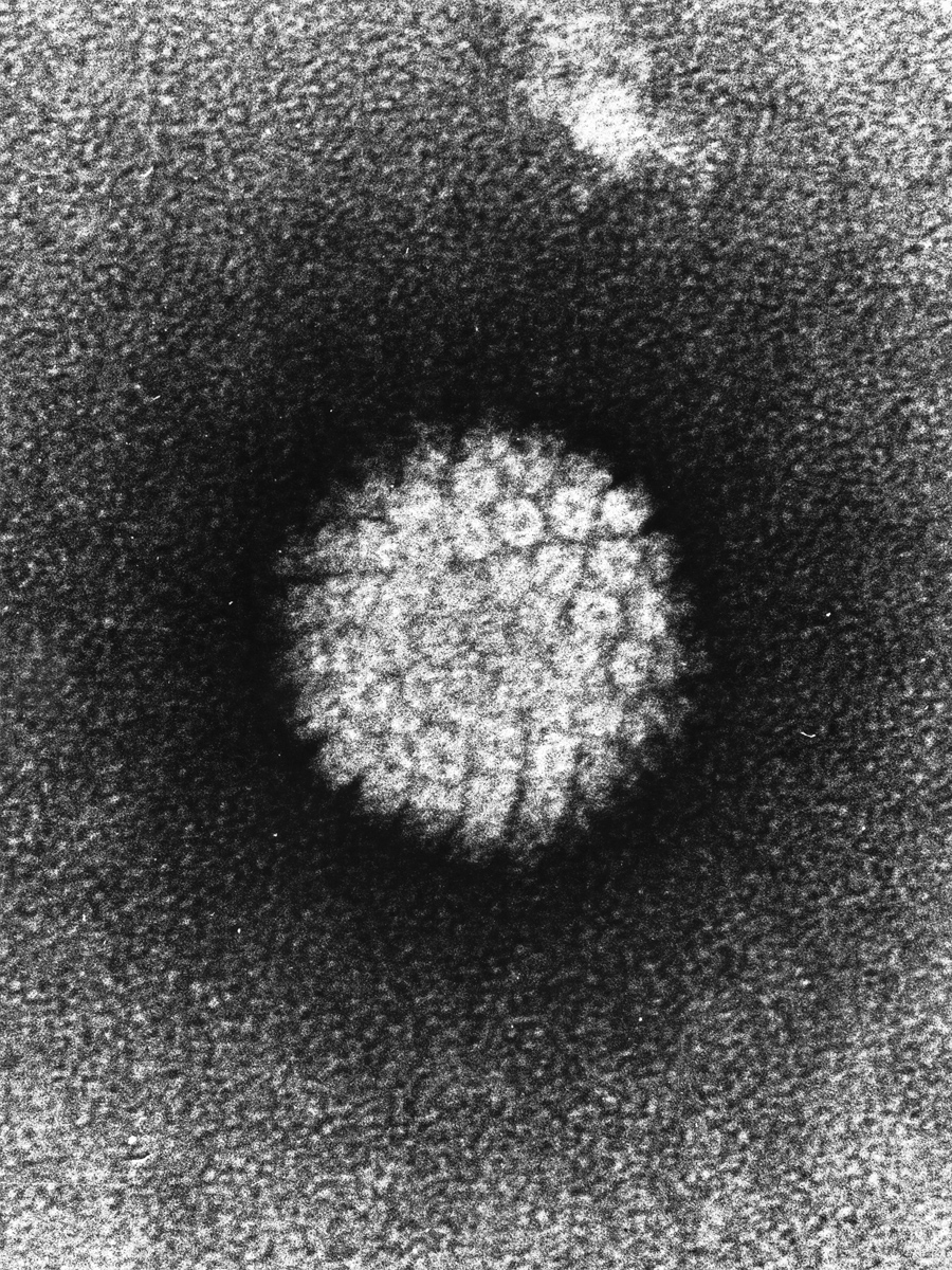 EM of HPV