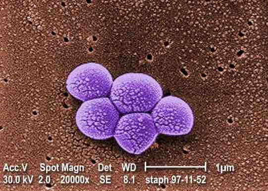 Resistant bacterial strain