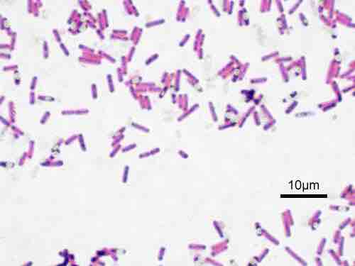 Humans use of prokaryotes