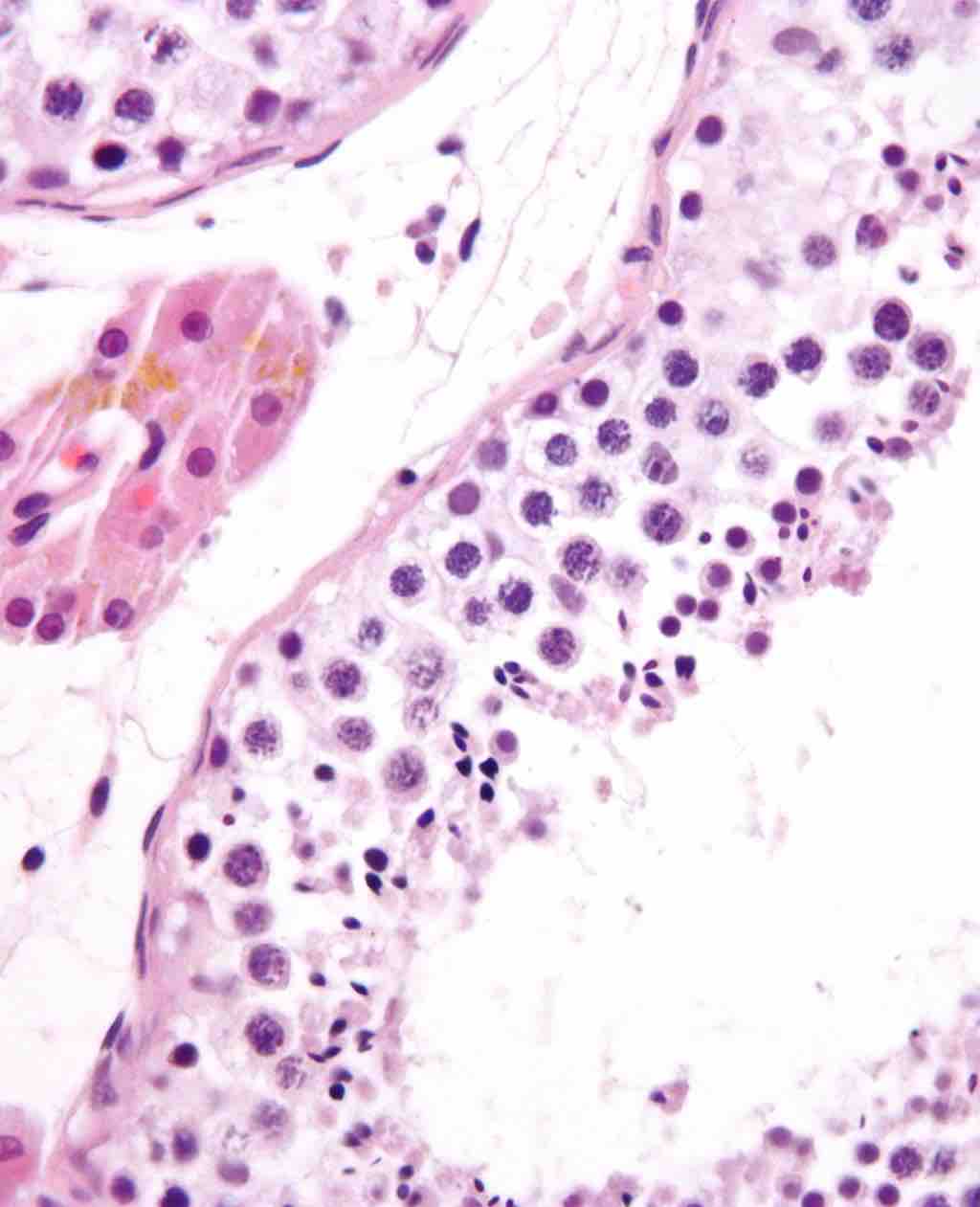 Seminiferous Tubule