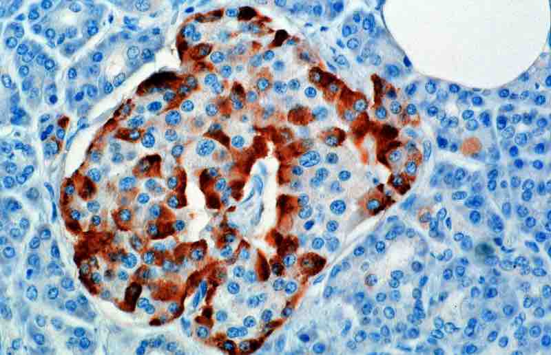 Glucagon staining