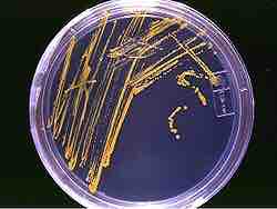 An agar plate with microorganisms