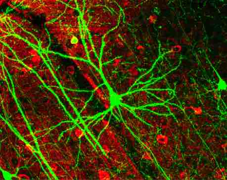 Newly developed neurons in the hippocampus of the adult mouse