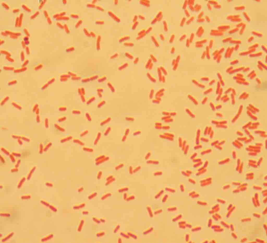 Microscopic examination of E. coli