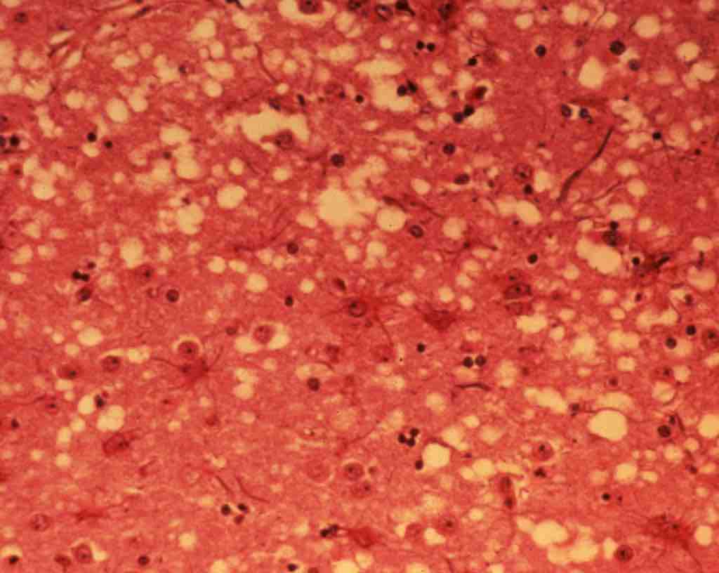 BSE infected brain tissue