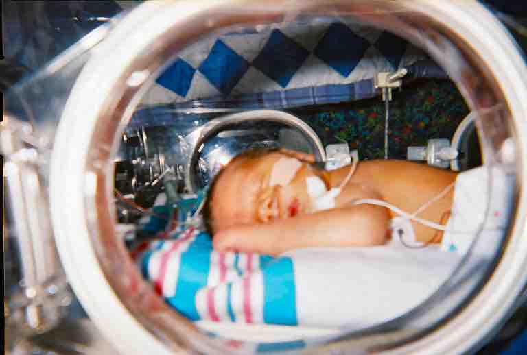 Infant in incubator