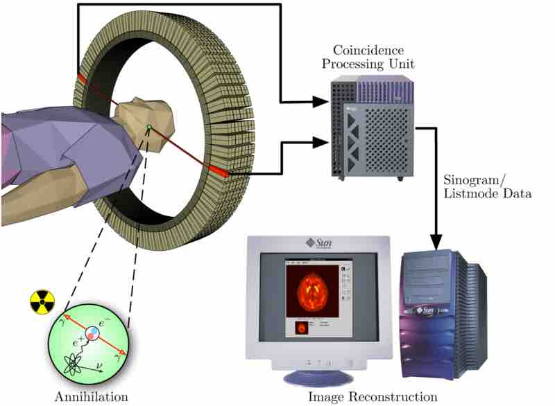 Positron Emission Tomography Acquisition Process