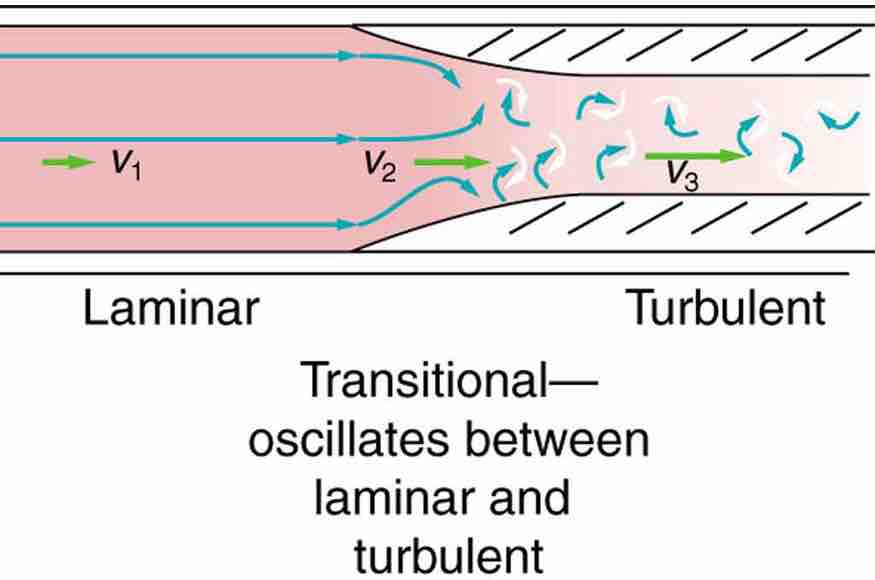 Turbulent Flow in an Artery