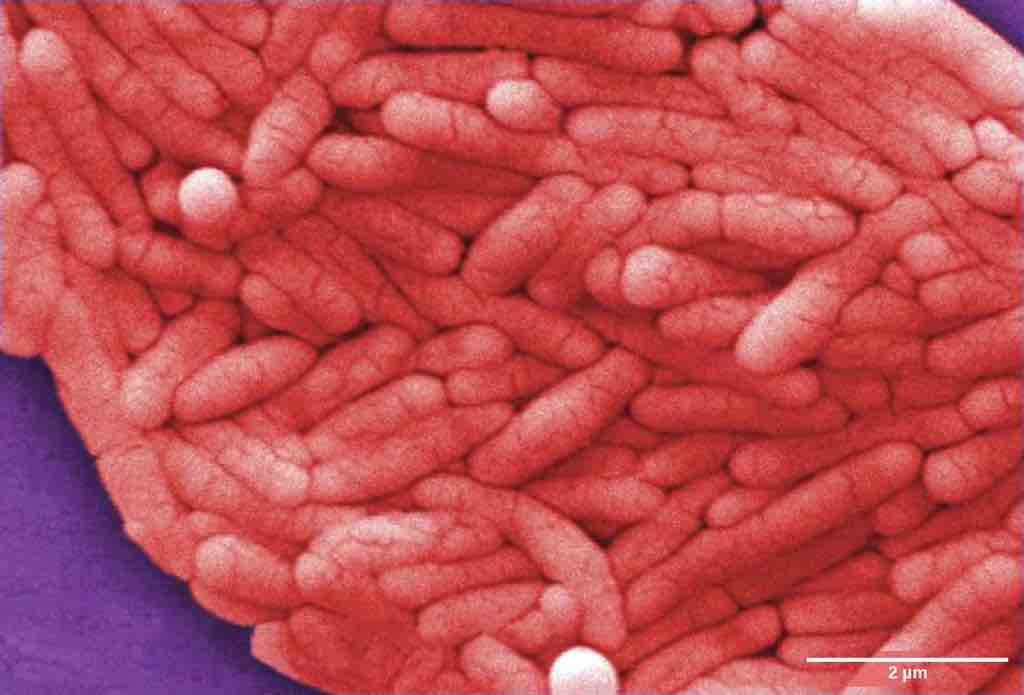 Salmonella enterica serovar typhi