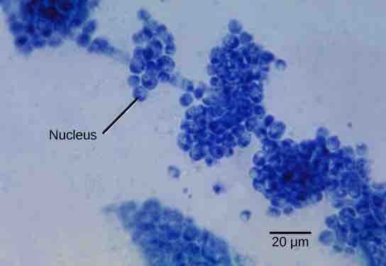 Example of a unicellular fungus
