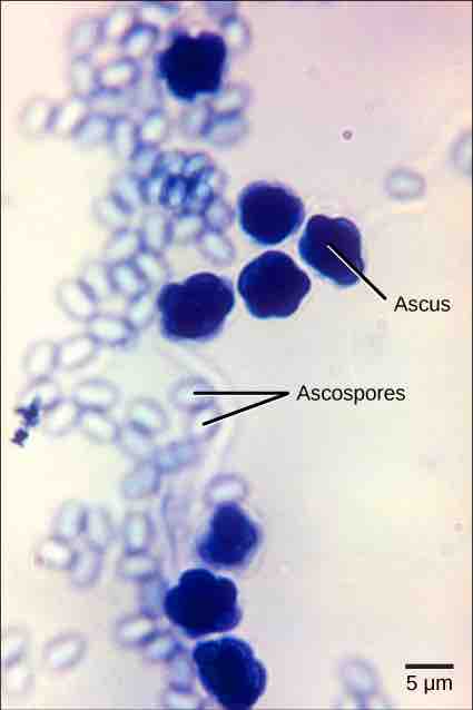 Release of ascospores