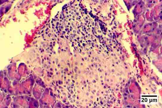 Islets of Langerhans