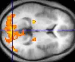 An fMRI of the brain