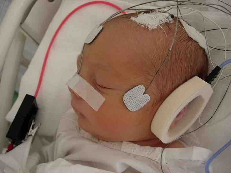 Baby in the NICU (neonatal intensive care unit)