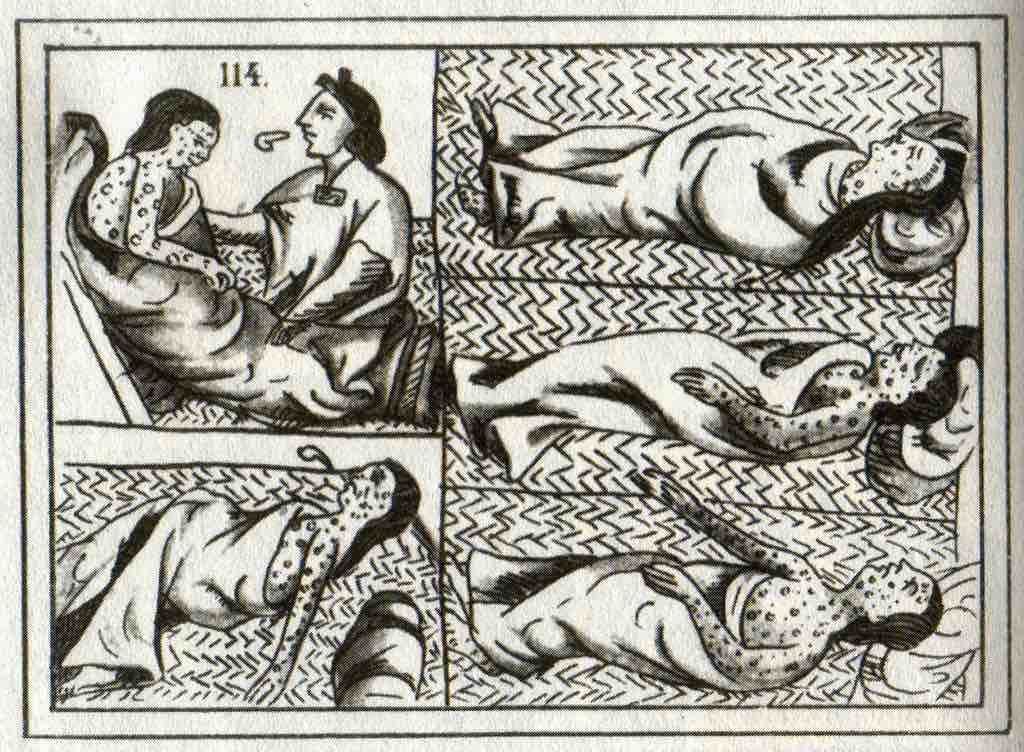 16th-century smallpox