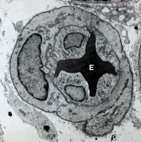 Vasoconstriction