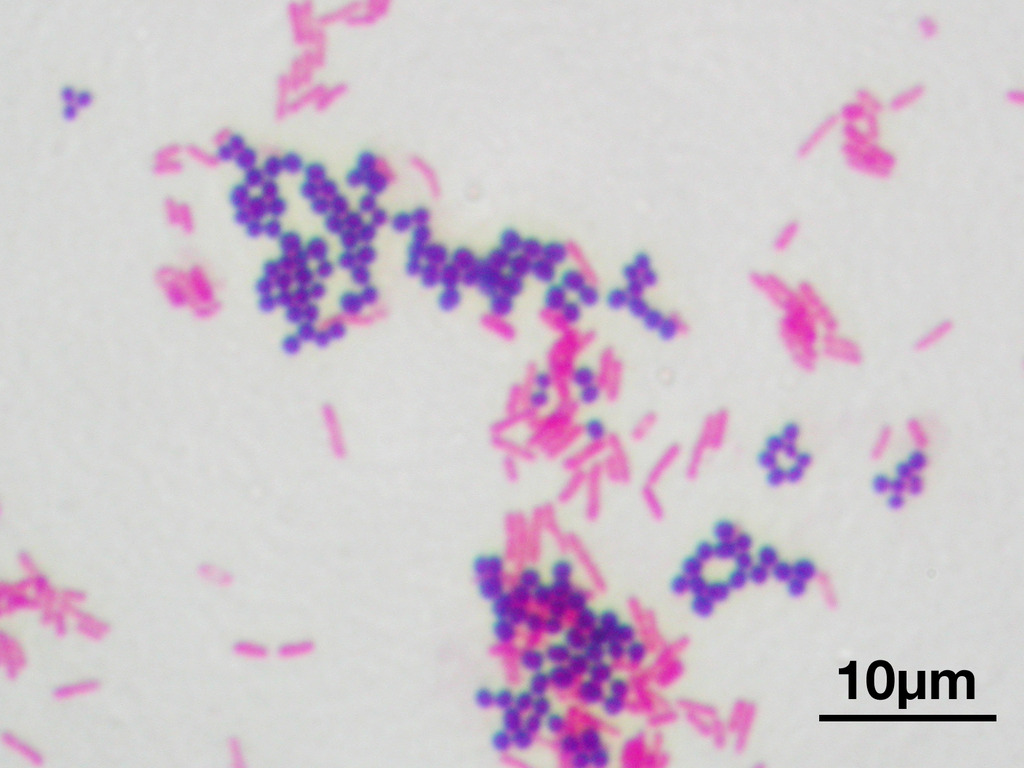 Gram Stain