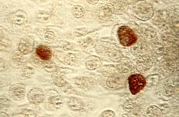 Chlamydias bacteria group