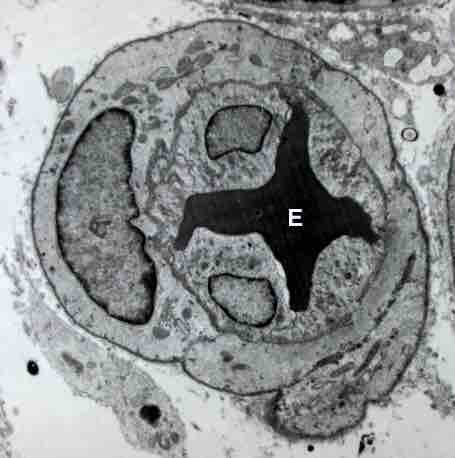 Vasoconstriction during hemostasis