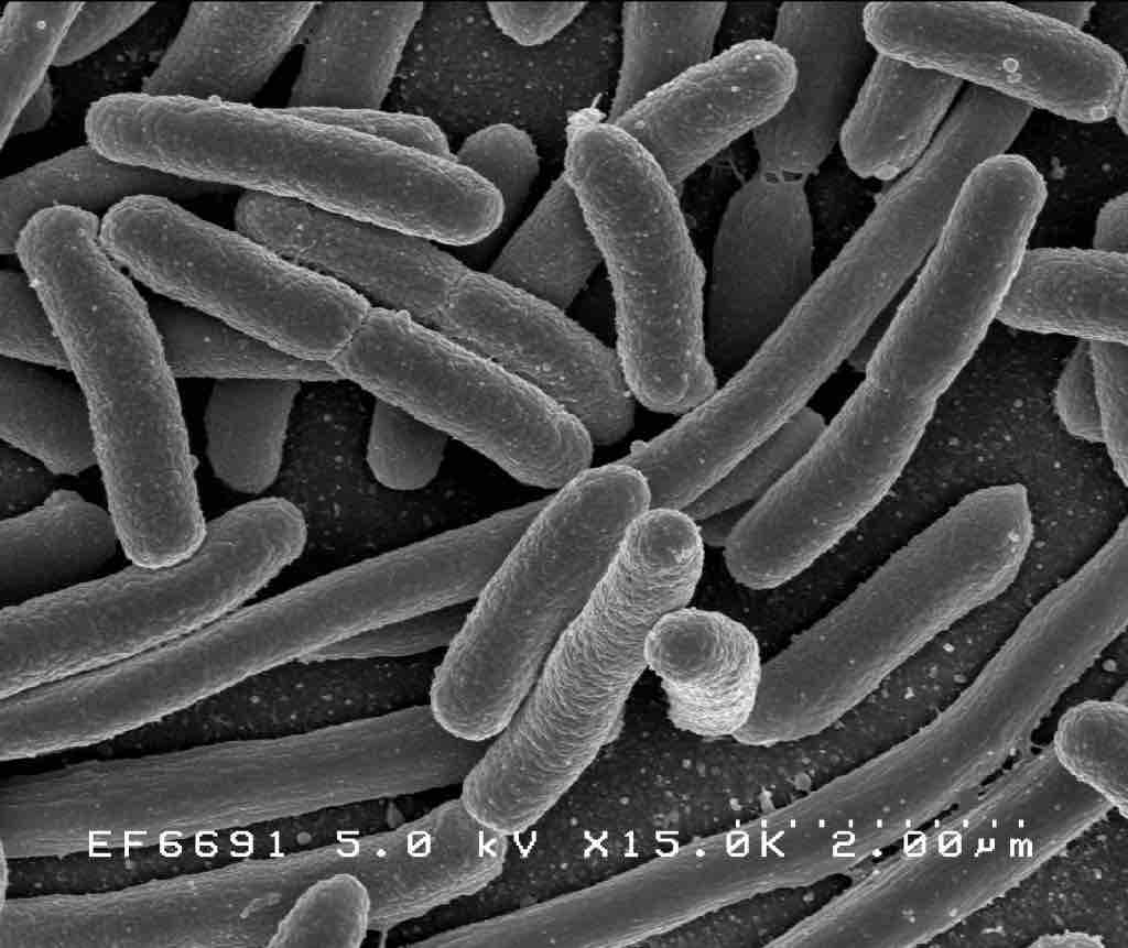 Classification of E. coli