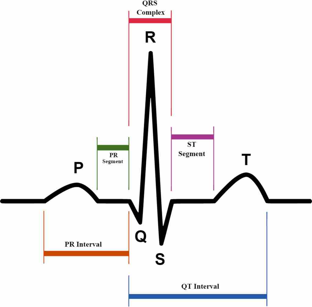 ECG Graph