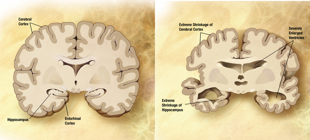 Brain Scans