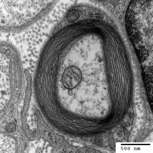 Illustration of the Schwann Cells and the Myelin Sheath