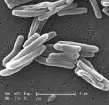 Electron micrograph of Mycobacterium tuberculosis.