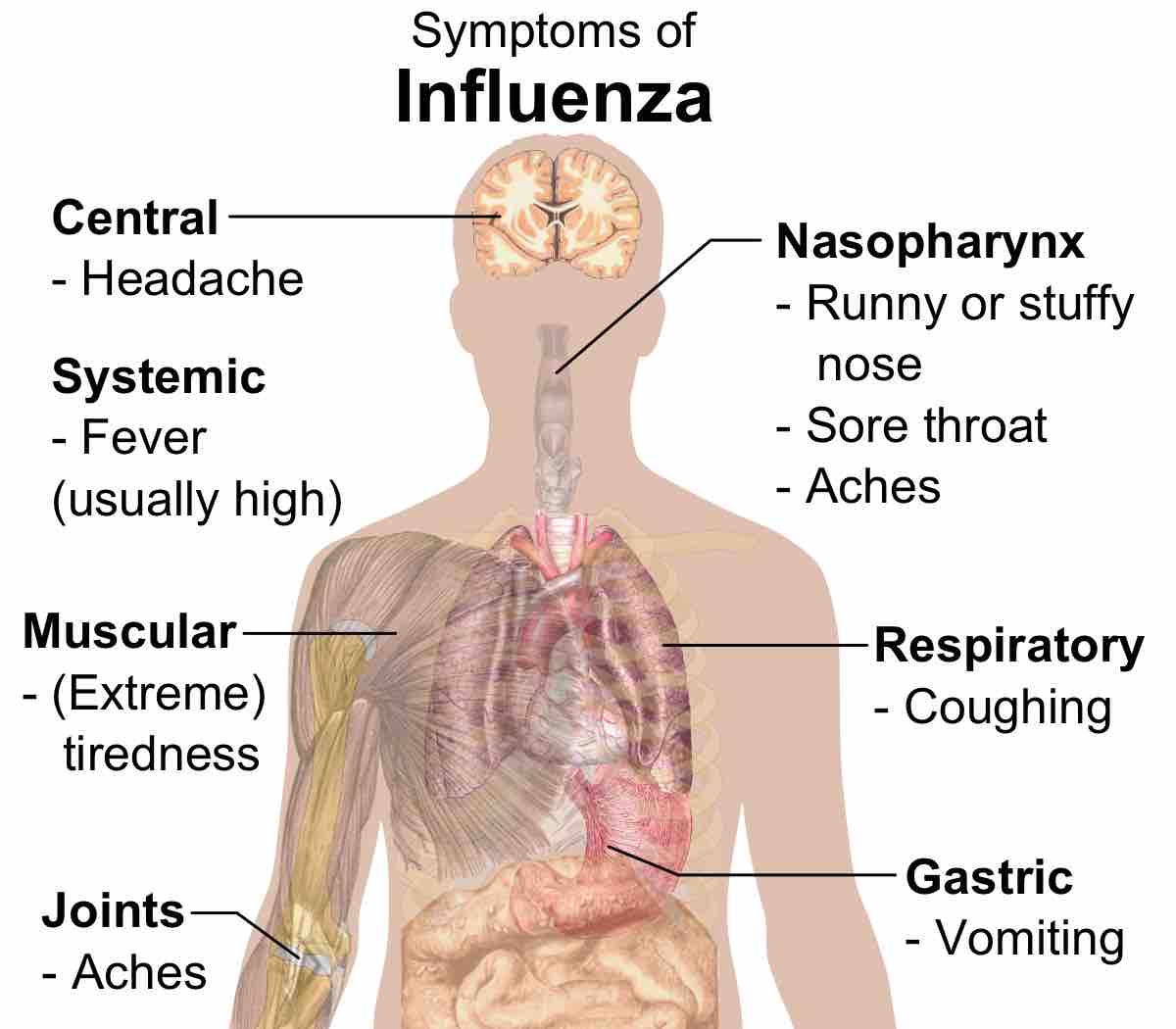 Symptoms of influenza