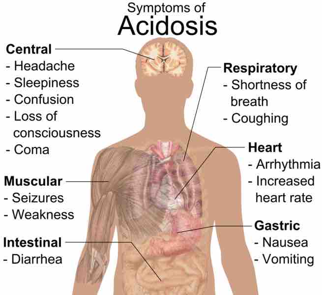 Symptoms of Acidosis