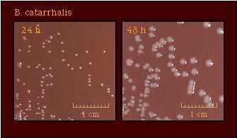 Colony Morphology