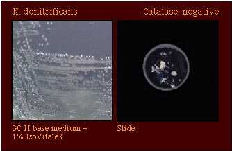 catalase