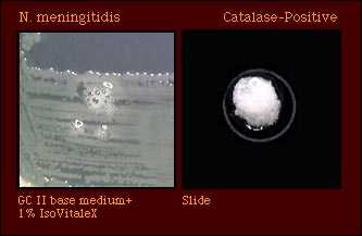 catalase