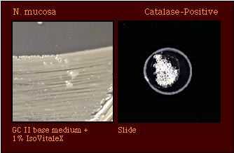 catalase