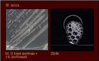 catalase