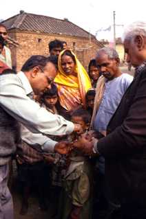 An oral polio vaccine dosage being given to a child