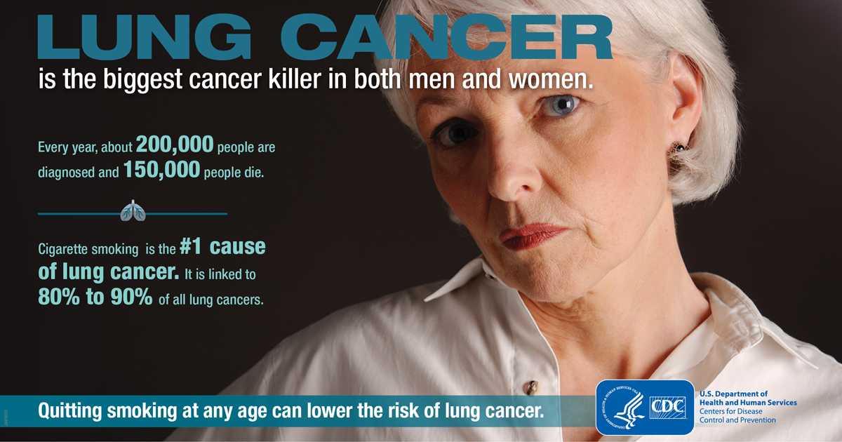 Lung cancer is the biggest cancer killer in both men and women. Every year, about 200,000 people are diagnosed and 150,000 people die. Cigarette smoking is the number 1 cause of lung cancer. It is linked to 80 to 90 percent of all lung cancers. Quitting smoking at any age can lower the risk of lung cancer.