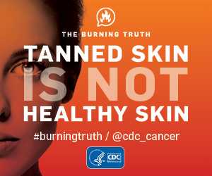 Tanned Skin Is Not Healthy Skin