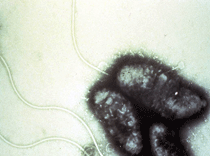 cholera magnified