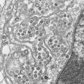 Negative stain electron microscopy shows a novel coronavirus particle with club-shaped surface projections surrounding the periphery of the particle, a characteristic feature of coronaviruses.