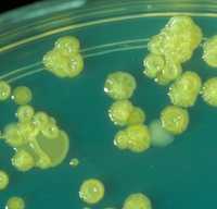 Cronobacter growing in a laboratory.