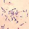 Corynebacterium diphtheriae bacteria