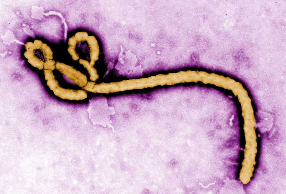 Ebola Virus