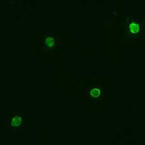 Agarose gel (2%) analysis of a PCR diagnostic test for species-specific detection of Plasmodium DNA.