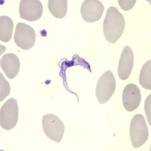 	Trypanosomiasis, African