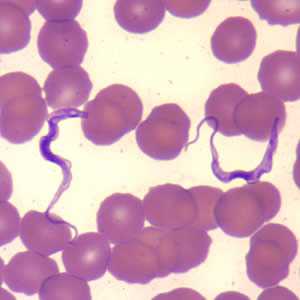 	Trypanosomiasis, African